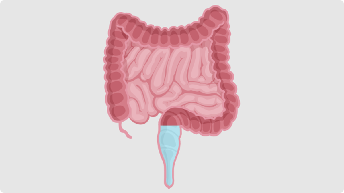 What is low-volume TAI?